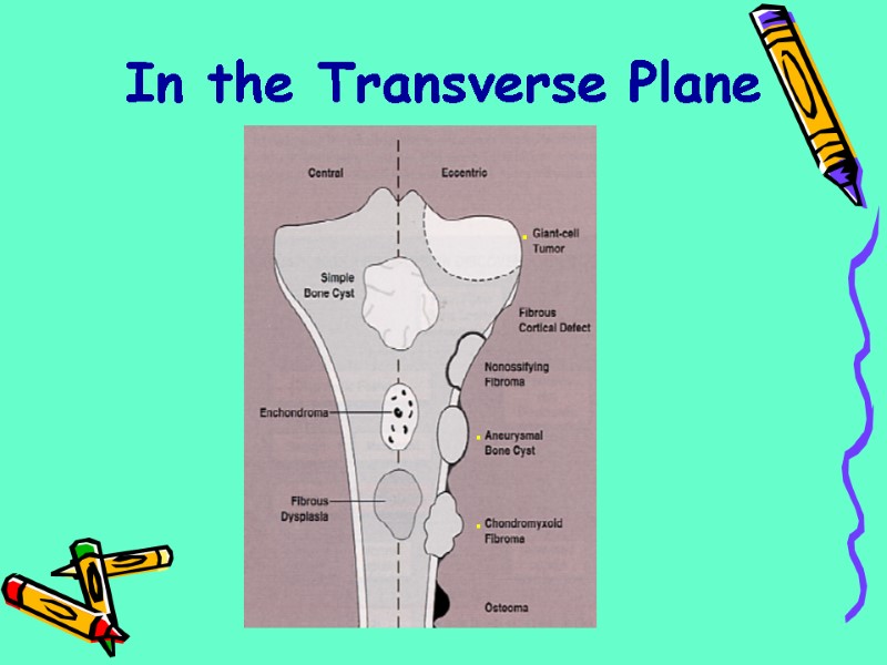 In the Transverse Plane